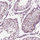 Immunohistochemical staining of human testis shows high expression.