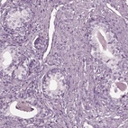 Immunohistochemical staining of human prostate shows low expression as expected.
