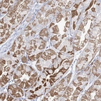 Anti-RCHY1 Antibody