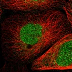 Immunofluorescent staining of human cell line A-431 shows localization to nucleoplasm & cytosol.