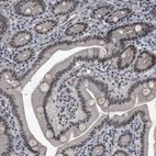Immunohistochemical staining of human duodenum shows moderate nuclear positivity in glandular cells.