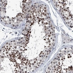 Immunohistochemical staining of human testis shows strong nuclear positivity in cells in seminiferous ducts.