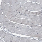 Immunohistochemical staining of human skeletal muscle shows no positivity in myocytes as expected.