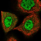 Immunofluorescent staining of human cell line A-431 shows localization to nucleoplasm & cytosol.