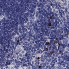 Anti-FRMD1 Antibody