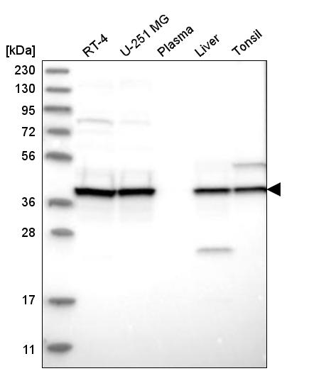 Anti-UROD Antibody