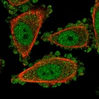Immunofluorescent staining of human cell line PC-3 shows localization to nucleoplasm & cytosol.