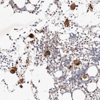 Anti-MTMR11 Antibody