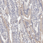 Anti-NT5DC1 Antibody