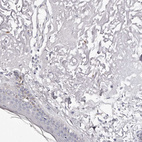 Immunohistochemical staining of human skin shows negative cytoplasmic positivity both in fibroblasts and keratinocytes as expected.