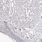 Immunohistochemical staining of human skin shows negative cytoplasmic positivity both in fibroblasts and keratinocytes as expected.