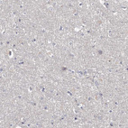 Immunohistochemical staining of human cerebral cortex shows negative cytoplasmic positivity both in neuronal cells and glial cells as expected.