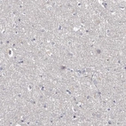 Immunohistochemical staining of human cerebral cortex shows negative cytoplasmic positivity both in neuronal cells and glial cells as expected.