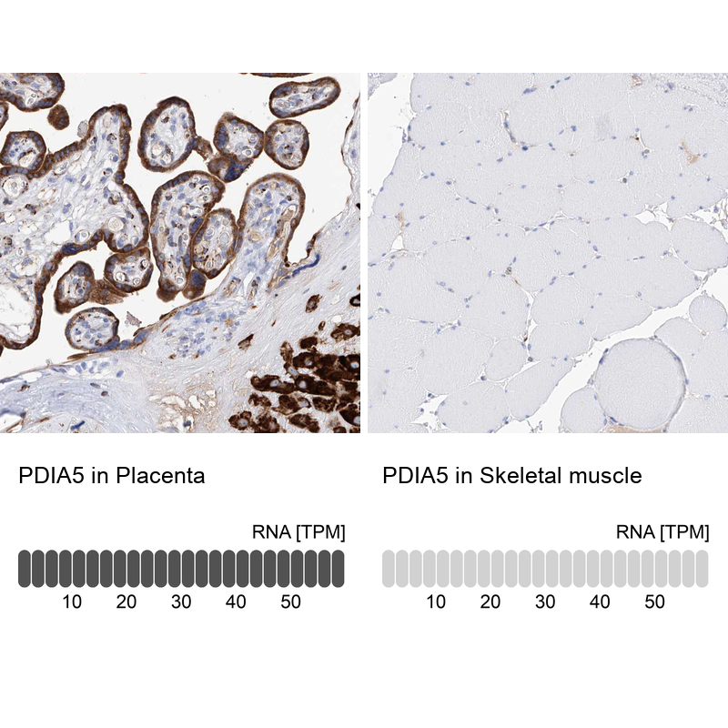 Anti-PDIA5 Antibody