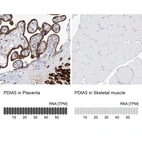 Anti-PDIA5 Antibody