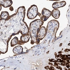 Immunohistochemical staining of human placenta shows strong granular cytoplasmic positivity in trophoblastic and decidual cells.