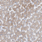 Immunohistochemical staining of human liver shows moderate granular cytoplasmic positivity in hepatocytes.
