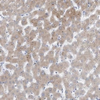 Immunohistochemical staining of human liver shows moderate granular cytoplasmic positivity in hepatocytes.