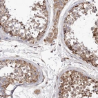 Immunohistochemical staining of human testis shows moderate to strong granular cytoplasmic positivity Leydig cells and in cells in seminiferous ducts.