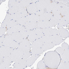 Immunohistochemical staining of human skeletal muscle shows no positivity in myocytes as expected.