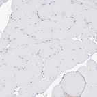 Immunohistochemical staining of human skeletal muscle shows no positivity in myocytes as expected.