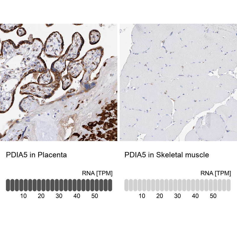 Anti-PDIA5 Antibody