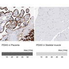 Anti-PDIA5 Antibody