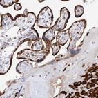 Immunohistochemical staining of human placenta shows strong granular cytoplasmic positivity in trophoblastic and decidual cells.
