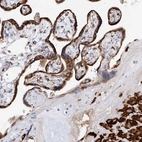 Immunohistochemical staining of human placenta shows strong granular cytoplasmic positivity in trophoblastic and decidual cells.