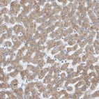 Immunohistochemical staining of human liver shows moderate granular cytoplasmic positivity in hepatocytes.