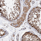Immunohistochemical staining of human testis shows moderate to strong granular cytoplasmic positivity Leydig cells and in cells in seminiferous ducts.