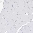 Immunohistochemical staining of human skeletal muscle shows no positivity in myocytes as expected.
