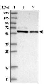 Lane 1: Marker [kDa] 230, 130, 95, 72, 56, 36, 28, 17, 11_br/_Lane 2: Human cell line RT-4_br/_Lane 3: Human cell line U-251MG sp