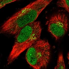 Immunofluorescent staining of human cell line U-251 MG shows localization to nucleoplasm, nucleoli fibrillar center & the Golgi apparatus.