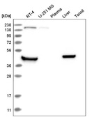 Anti-RHBDL1 Antibody