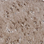 Anti-LYRM4 Antibody