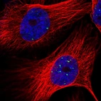 Immunofluorescent staining of human cell line U-251 MG shows localization to nuclear bodies.