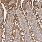 Anti-NDUFB11 Antibody