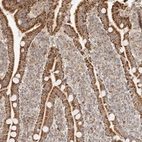 Anti-NDUFB11 Antibody