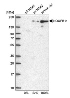 Western blot analysis in U2OS cells transfected with control siRNA, target specific siRNA probe #1 and #2, using Anti-NDUFB11 antibody. Remaining relative intensity is presented.