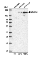 Western blot analysis in U2OS cells transfected with control siRNA, target specific siRNA probe #1 and #2, using Anti-NDUFB11 antibody. Remaining relative intensity is presented.