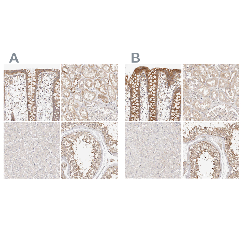 Anti-KCMF1 Antibody