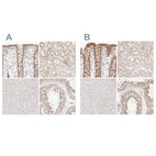 Anti-KCMF1 Antibody