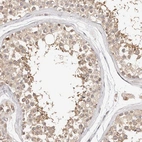 Immunohistochemical staining of human testis shows weak to moderate cytoplasmic positivity in cells in seminiferous ducts.