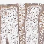 Immunohistochemical staining of human colon shows moderate cytoplasmic positivity in glandular cells.