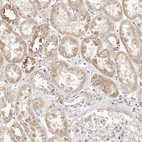 Immunohistochemical staining of human kidney shows weak to moderate cytoplasmic positivity in cells in tubules.