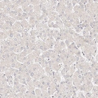 Immunohistochemical staining of human liver shows no cytoplasmic positivity in hepatocytes as expected.