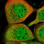 Immunofluorescent staining of human cell line A-431 shows localization to nucleoplasm & cytosol.