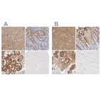 Immunohistochemical staining of human cerebral cortex, duodenum, kidney and skeletal muscle using Anti-GDA antibody HPA030387 (A) shows similar protein distribution across tissues to independent antibody HPA024099 (B).