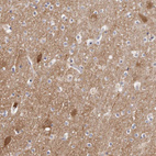 Immunohistochemical staining of human cerebral cortex shows moderate cytoplasmic positivity in neurons.